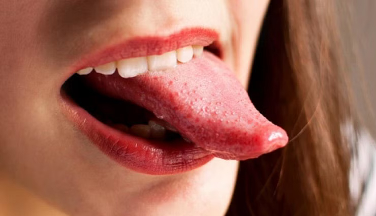 color of your tongue tells about your health,healthy living,Health tips