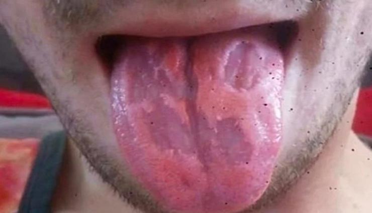 tongue damage by energy drink,dangers of tongue,energy drink harms,weird story,omg,weird story in hindi