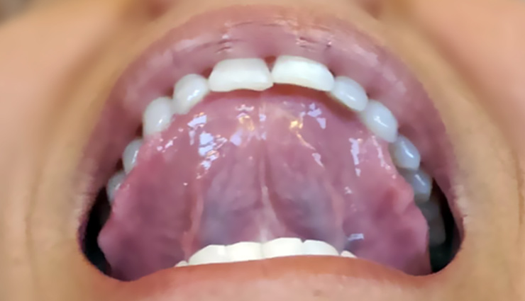 home remedies for hiccups,how to stop hiccups fast,natural remedies for hiccups,ways to get rid of hiccups,cure hiccups at home,hold breath for hiccups,drink water for hiccups,hiccups treatment,stop hiccups naturally,remedies for chronic hiccups