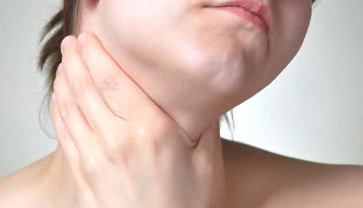 5 Home Remedies To Get Rid of Tonsillitis