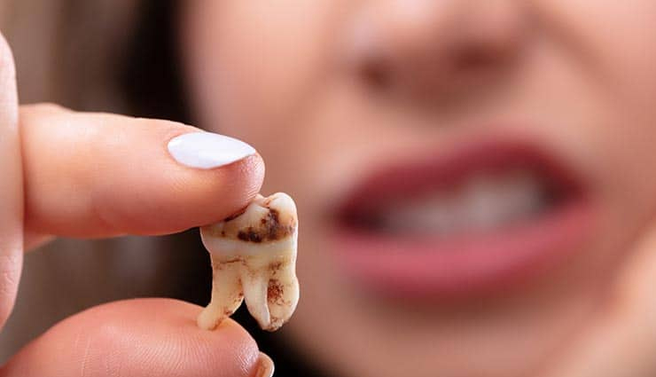 excess date consumption,date fruit side effects,negative effects of consuming too many dates,digestive issues from eating too many dates,excessive sugar intake from dates,allergic reactions to dates,weight gain from overeating dates