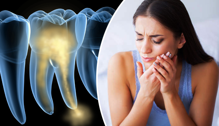 Home Remedies To Help You Get Relief From Tooth Pain