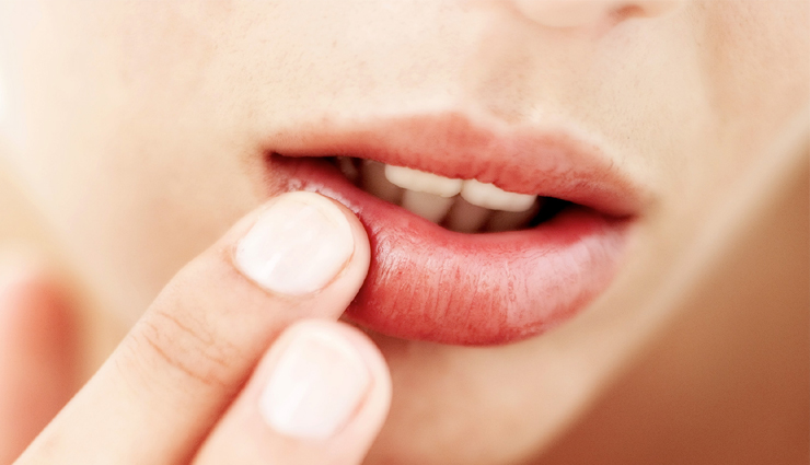 lips care routine,lips care at home,lips care in winter,lips care home remedies,lips care tips,lips care at night,lips care articles,lips after care,lips care tips at home,best lips care cream,lip care for cracked lips,lips care dry,lips daily care,lip care dark lips,easy lips care tips,lip care for dry lips,lip care for black lips,lips care homemade tips,lips care hacks,lips home care,dry lips care home remedies,lips care in winter at home,lips care kaise kare,lips ki care kaise kare,lip care lips,lip care dry lips,lip care rosy lips,male lips care,my lips care routine,lips care naturally,lips care natural remedies,lips care tips natural,lip care of dry lips,care of lips,care of lips at home,care of lips in winter,lips care beauty products,lips skin care products,lip care pigmented lips