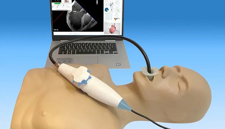 heart disease diagnosis tests,noninvasive cardiac tests,cardiovascular diagnostic procedures,diagnostic tests for heart conditions,heart health examinations,echocardiogram procedure,transesophageal echocardiography (tee),electrocardiogram (ecg or ekg) test,magnetic resonance imaging (mri) for heart,ct scan for cardiac evaluation,exercise cardiac stress test,pharmacologic stress test,tilt test for fainting,ambulatory rhythm monitoring,holter monitoring,event recorders,mobile cardiac telemetry (mct),coronary angiogram procedure,heart artery examination,coronary artery blockage detection