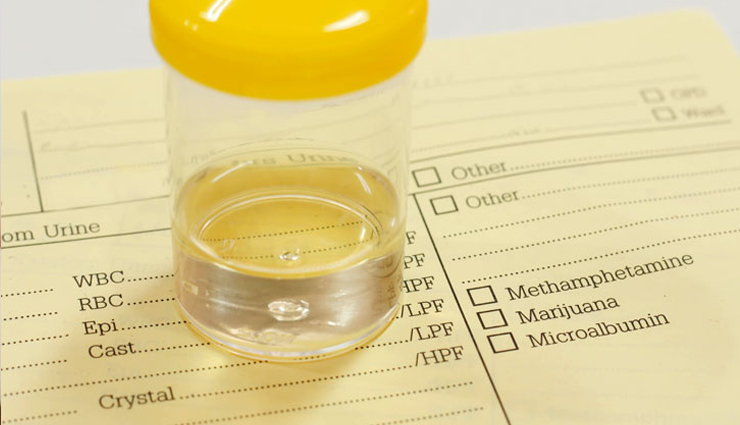 urine color,meaning of urine color,urine,Health,Health tips