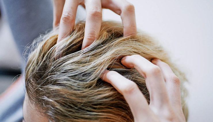 5 Most Common Hair Transplant Myths You Should Not Believe In