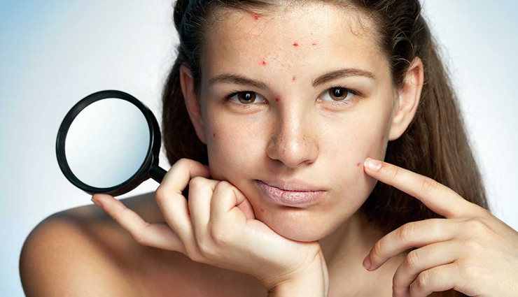 castor oil,castor oil skin.skin problem,skin care tips,castor oil beauty benefits,beauty tips,beauty benefits