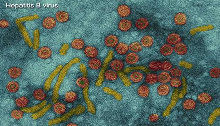 इन घरेलू उपचारों की मदद से करे हेपेटाइटिस बी का इलाज