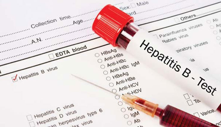 treatment of hepatitis b,hepatitis b