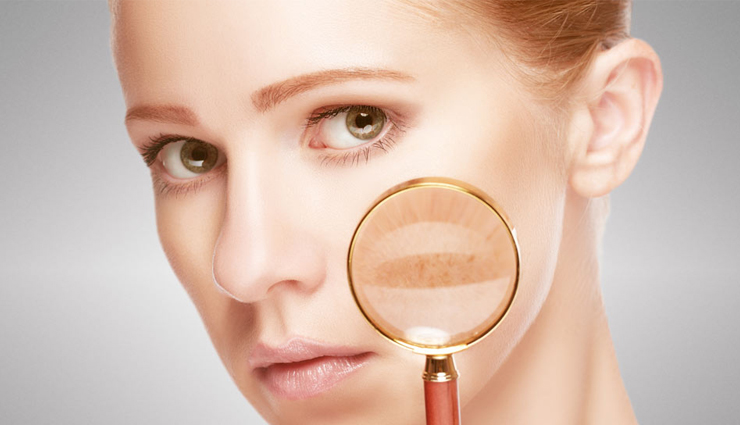 beauty tips,beauty,home remedies,5 ways onion is treating your skin,hoe onion is treating skin,skin benefits of onion,how onion is good for skin,onion is very good for skin,onion,skin benefits