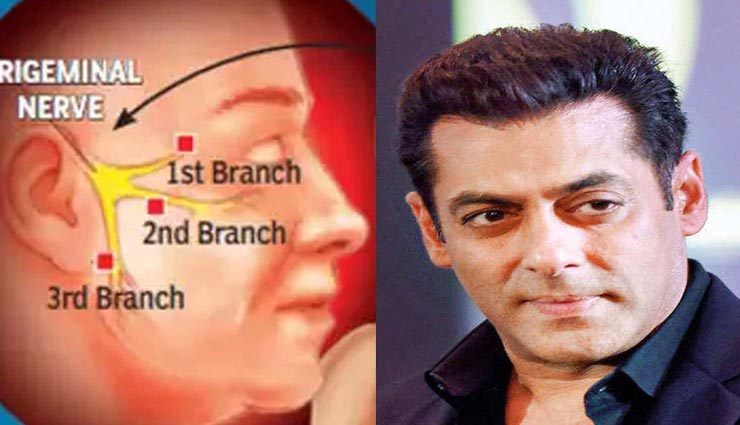 Health tips,health tips in hindi,Salman Khan,Trigeminal neuralgia,rare disease