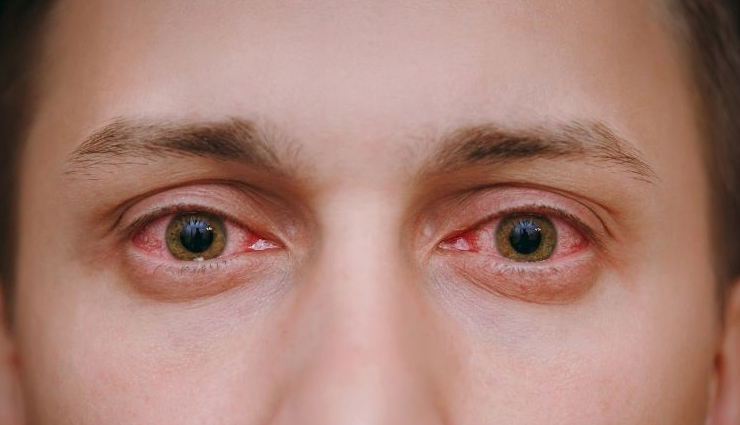 triphala,health benefits of triphala,Health tips,fitness tips