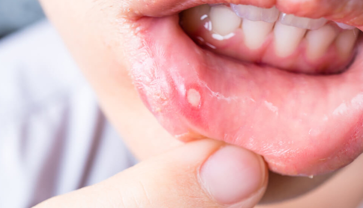 triphala,health benefits of triphala,Health tips,fitness tips