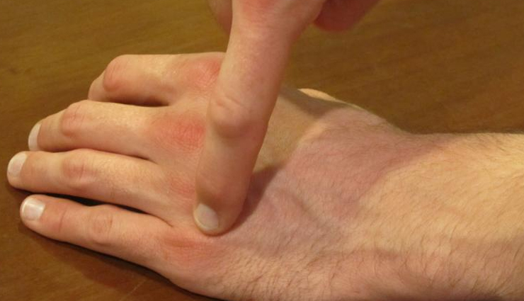 acupressure,acupressure tips,acupressure for health,what is acupressure,how does acupressure work,Health,Health tips