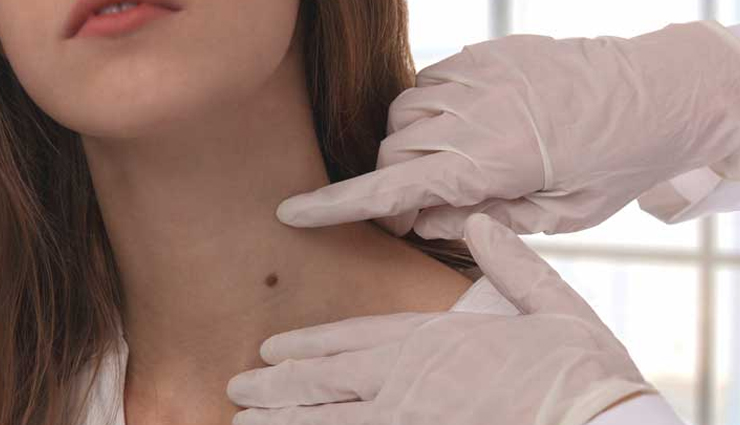 9 Remedies To Treat Tumor Naturally