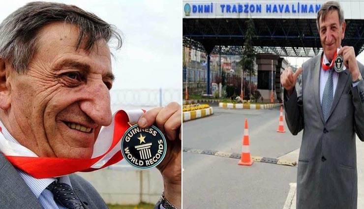 71 की उम्र में भी लगातार बढ़ रही है इस शख्स की नाक, गिनीज बुक ऑफ़ वर्ल्ड रिकॉर्ड में दर्ज है नाम