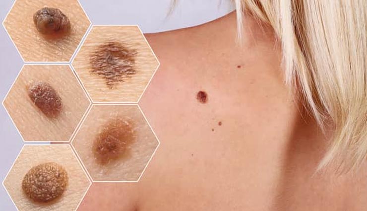 turmeric,beauty benefits of turmeric,skin care tips,beauty tips