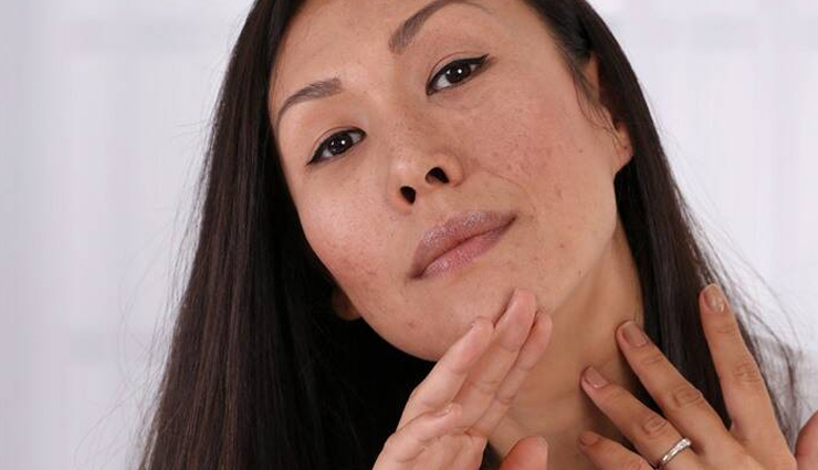 turmeric,beauty benefits of turmeric,beauty tips,skin care tips