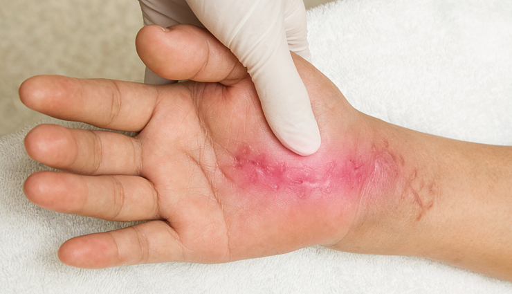 health benefits of turmeric,turmeric,Health tips,fitness tips