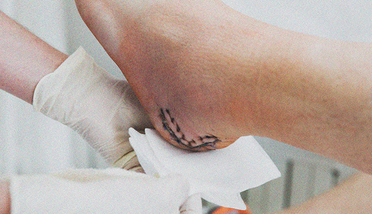 turmeric,health benefits of turmeric,Health tips,fitness tips