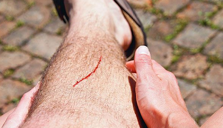 turmeric,health benefits of turmeric,Health tips,fitness tips