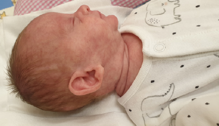 rare diseases in newborns,common diseases in newborns,genetic disorders in newborns,metabolic disorders in newborns,congenital anomalies in newborns,down syndrome in newborns,turner syndrome in newborns,fragile x syndrome in newborns,tay-sachs syndrome in newborns,phenylketonuria (pku) in newborns,orphan diseases in newborns,newborn health disorders,genetic conditions in infants,metabolic diseases in infants,rare congenital diseases in babies