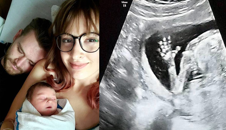इस महिला के पास है 2 योनी-2 गर्भाशय, बच्ची को दिया जन्म
