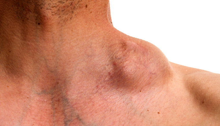 world cancer day common cancer types,10 most common cancers awareness,types of cancer to be aware of,common cancers on world cancer day,cancer prevalence and awareness,top 10 cancer types you should know,understanding common cancer varieties,global awareness of common cancers,key cancer types for awareness,world cancer day information on cancers,common cancer statistics and awareness,important cancers to be aware of,know the prevalence of common cancers,significance of knowing common cancer types,cancer awareness through common types,recognizing the 10 most prevalent cancers