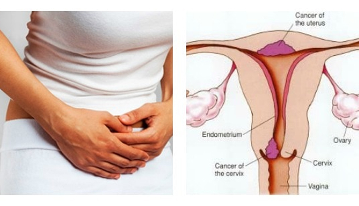 world cancer day common cancer types,10 most common cancers awareness,types of cancer to be aware of,common cancers on world cancer day,cancer prevalence and awareness,top 10 cancer types you should know,understanding common cancer varieties,global awareness of common cancers,key cancer types for awareness,world cancer day information on cancers,common cancer statistics and awareness,important cancers to be aware of,know the prevalence of common cancers,significance of knowing common cancer types,cancer awareness through common types,recognizing the 10 most prevalent cancers