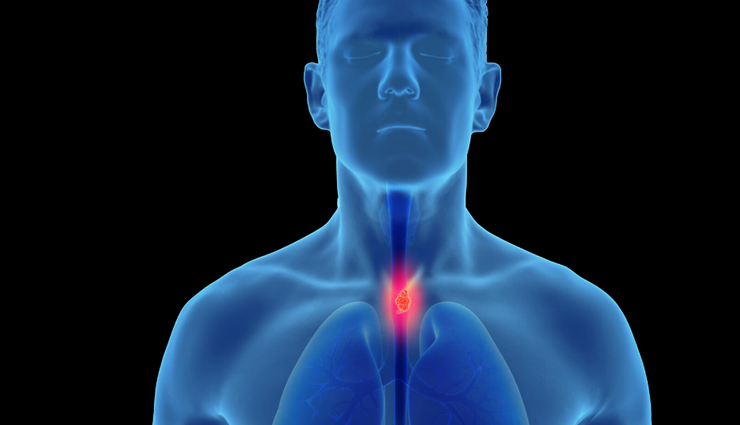 world cancer day common cancer types,10 most common cancers awareness,types of cancer to be aware of,common cancers on world cancer day,cancer prevalence and awareness,top 10 cancer types you should know,understanding common cancer varieties,global awareness of common cancers,key cancer types for awareness,world cancer day information on cancers,common cancer statistics and awareness,important cancers to be aware of,know the prevalence of common cancers,significance of knowing common cancer types,cancer awareness through common types,recognizing the 10 most prevalent cancers