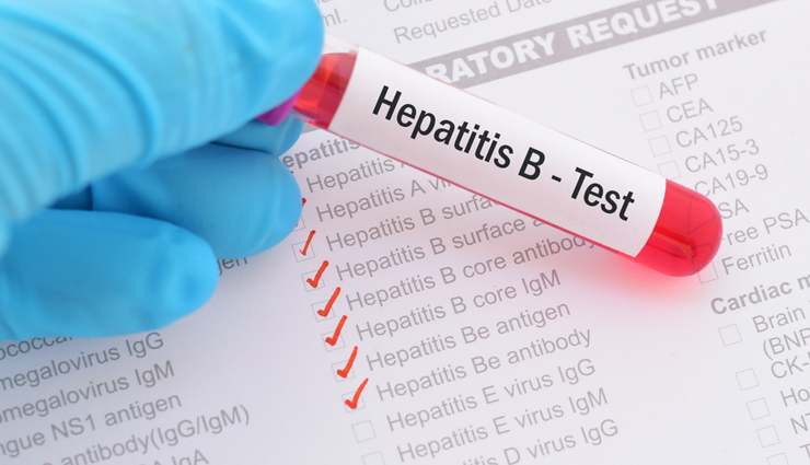 world hepatitis day,different types of viral hepatitis,hepatitis,Health tips,fitness tips