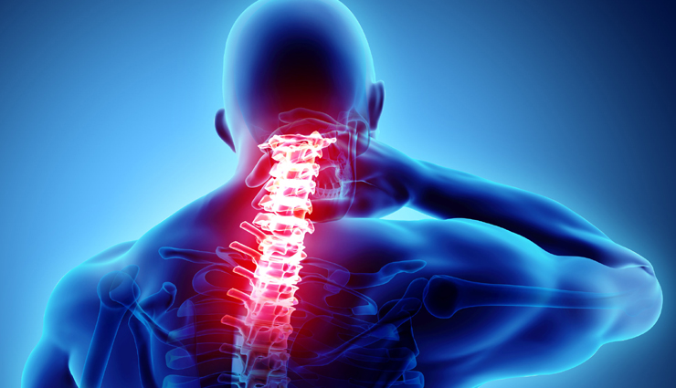 neck pain,reason for neck pain,remedies for neck pain,home remedies for neck pain,muscle pain,muscle cramps,headache,pain in neck joint,neck pain remedies,Health,Health tips