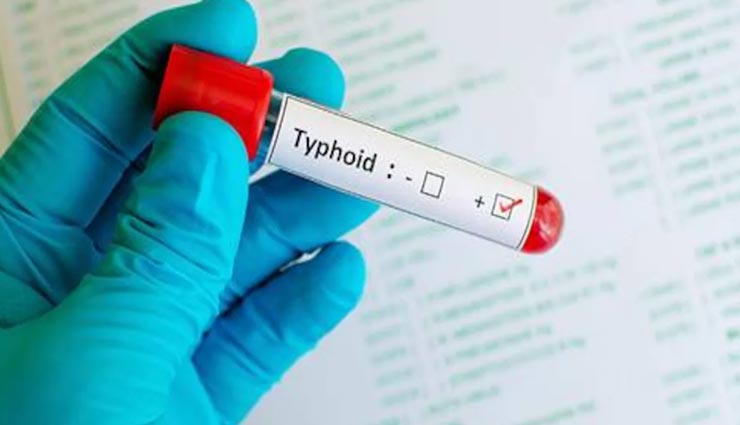 Health tips,health tips in hindi,infections in monsoon,coronavirus