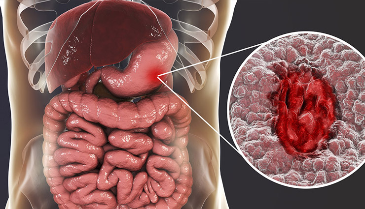 cardamom,health benefits of cardamom,cardamom health benefits,cardamom benefits