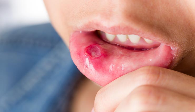 Health tips,health tips in hindi,curd benefits