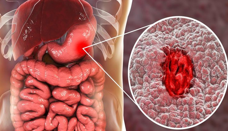 neem health benefits,benefits of neem for health,neems positive effects on health,neem and well-being,neems impact on wellness,health-promoting qualities of neem,neems role in a healthy lifestyle,neems nutritional advantages,neems medicinal benefits,neems healing properties