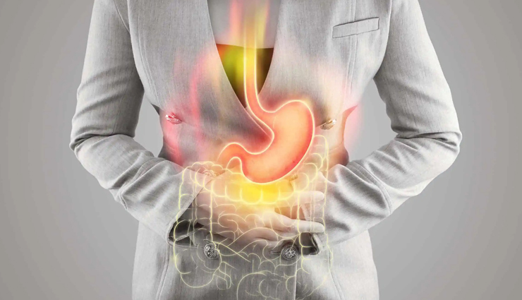 ulcer home remedies,natural remedies for ulcers,how to heal ulcers naturally,mouth ulcer treatment at home,peptic ulcer home cure,stomach ulcer natural treatment,herbal remedies for ulcers,home remedies for gastric ulcers,home treatment for mouth ulcers,ayurvedic remedies for ulcers,foods that heal ulcers,ulcer pain relief at home,natural ulcer healing methods