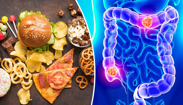 पिज्जा-बर्गर-कोल्ड ड्रिंक्स खाने से हो सकता है आंतों का कैंसर! वैज्ञानिकों ने कहा  - दूरी बना लेने में ही है समझदारी