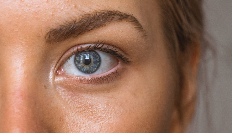 9 DIY Ways To Treat Under Eye Bags