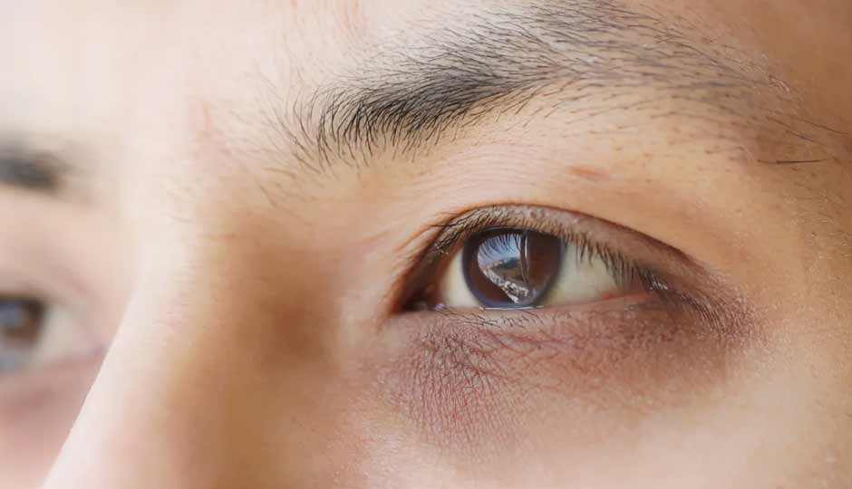 11 Home Remedies to Help Reduce Under-Eye Circles