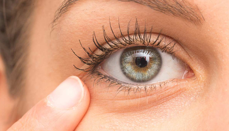 DIY Green Tea Cream To Treat Under Eye Wrinkles