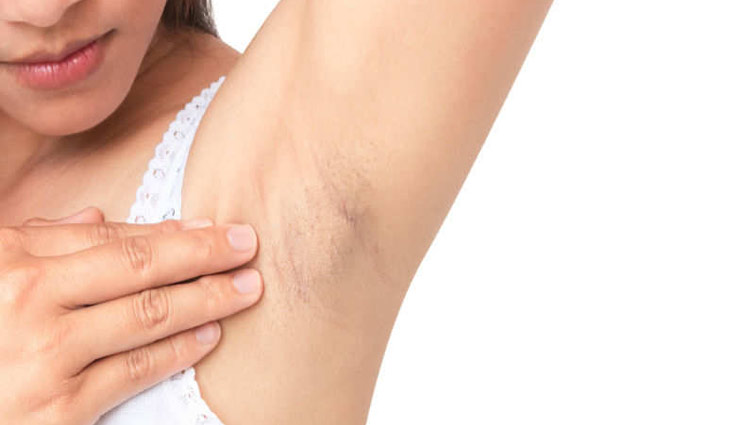 underarms hair,home remedies,skin care tips,beauty tips