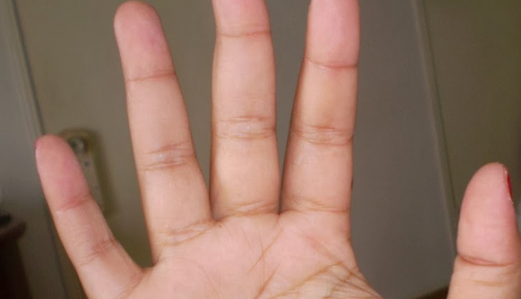 health warnings hands,signs of health issues hands,nail color health warning,swollen fingers health sign,tingling hands causes,dry skin health warning,hand shape deformities,health clues from hands,hands reveal health problems,health conditions visible in hands