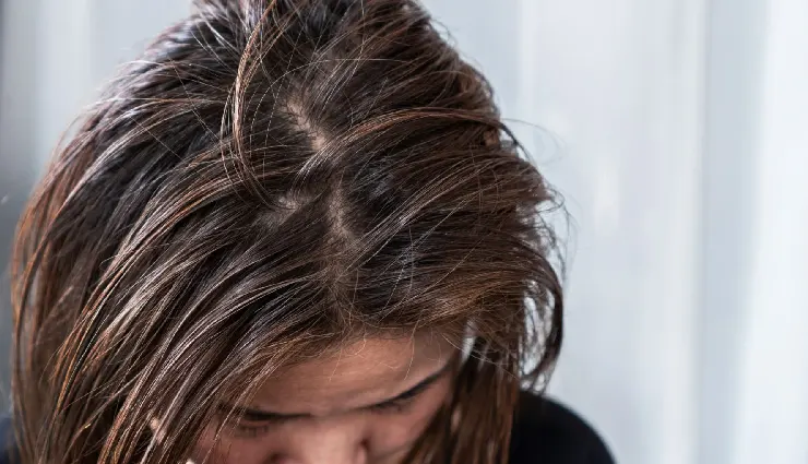 10 Tricks To Help You Hide Dirty Unwashed Hair