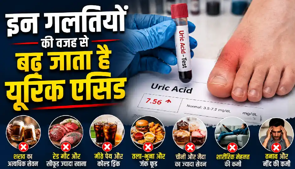 यूरिक एसिड बढ़ने की वजह बन सकती हैं आपकी रोजमर्रा की ये आदतें, जानिए इसे कंट्रोल करने के आसान उपाय