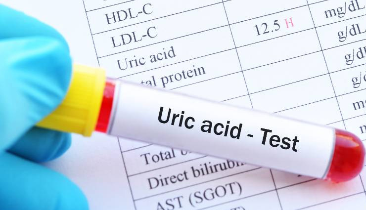 9 Healthy Foods That Will Help You Reduce Uric Acid