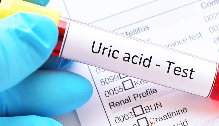 11 Effective Remedies To Treat High Uric Acid in Blood