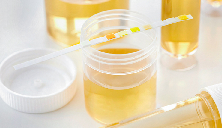 things about urine,urine,Health tips,fitness tips,facts about urine