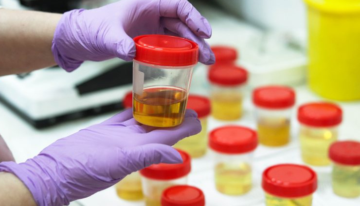 things about urine,urine,Health tips,fitness tips,facts about urine