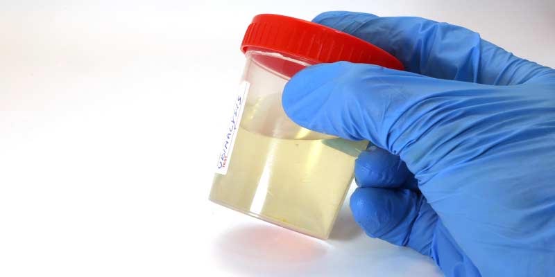 पेशाब के रंग से जानें कितने स्वस्थ है आप, बड़ी काम की है यह जानकारी urine,urine color,Health,Health tips,healthy living